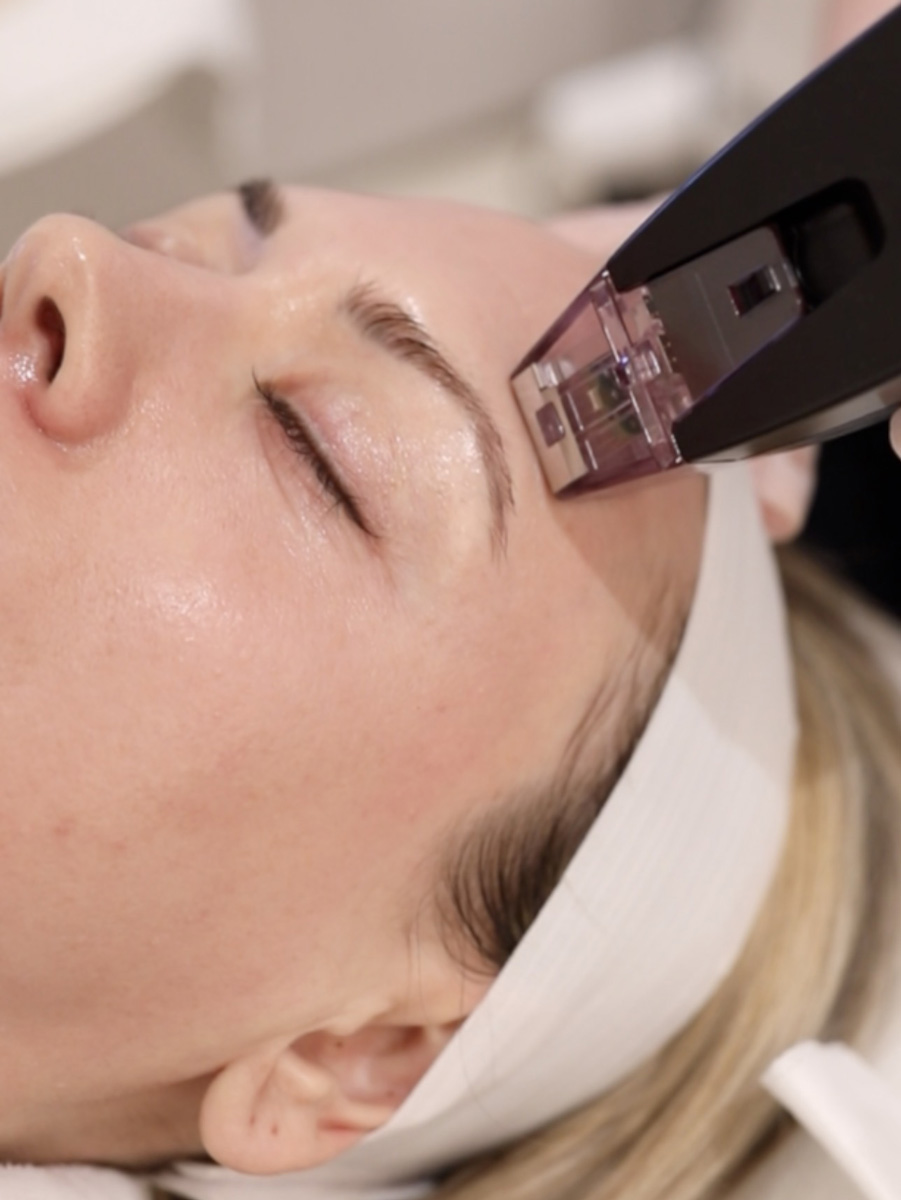 Clinical Studies Reveal the Full Potential of Microdermabrasion
