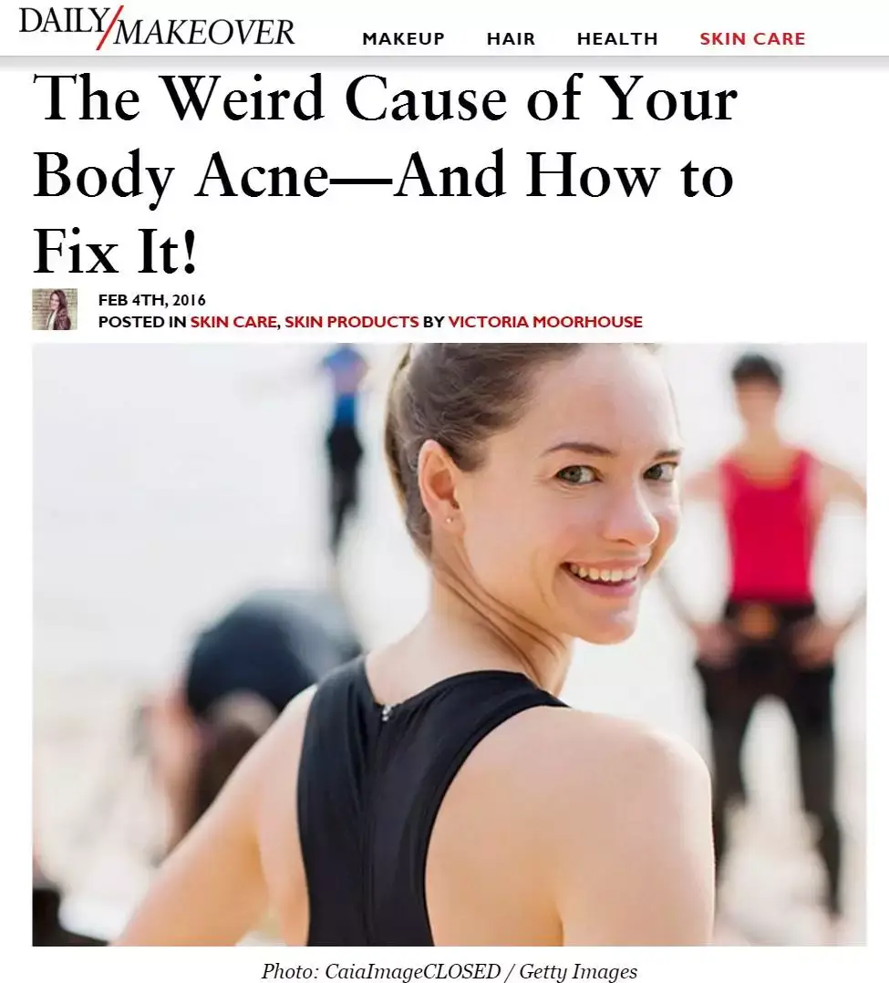 Body Acne Breakouts: Are Workout Clothes Really the Culprit?