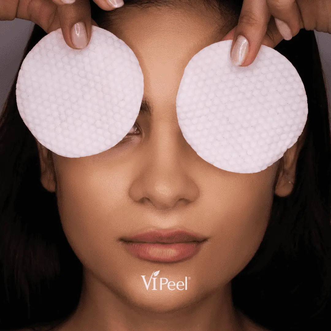 Vi Peels