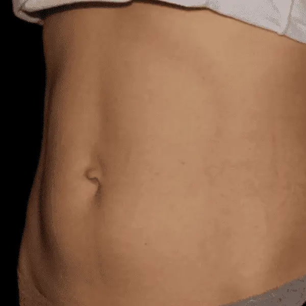 Skinney Medspa Treatments