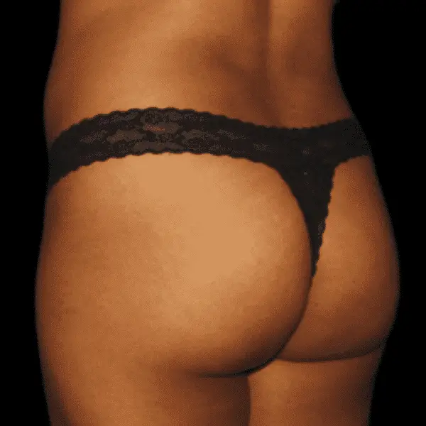 Skinney Medspa Treatments