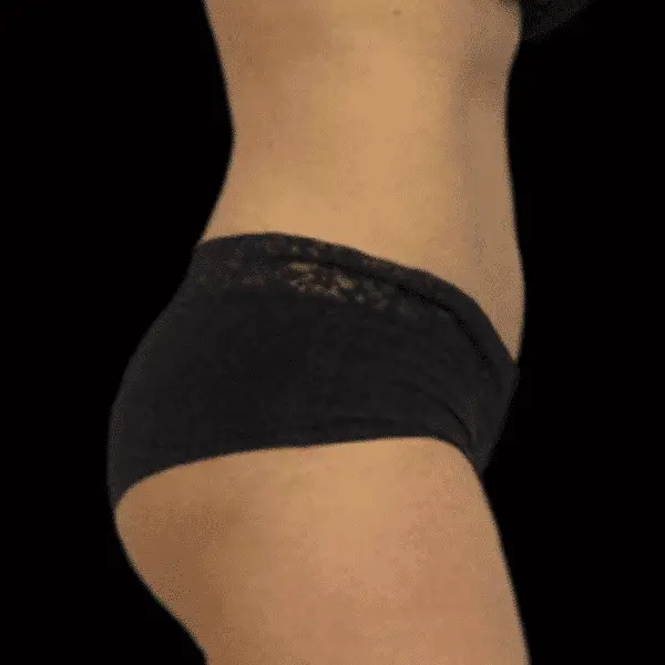 Skinney Medspa Treatments