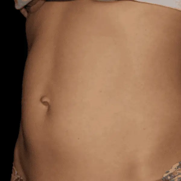 Skinney Medspa Treatments