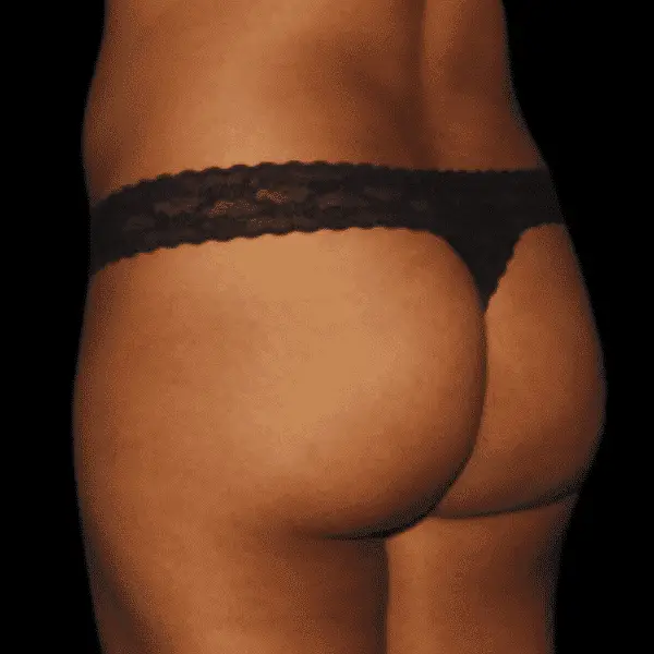 Skinney Medspa Treatments