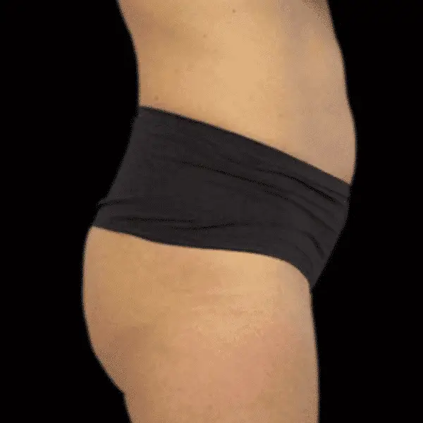 Skinney Medspa Treatments