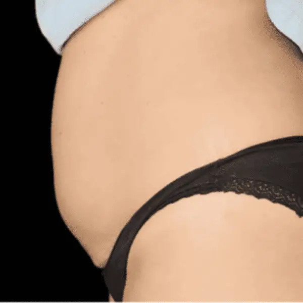 Skinney Medspa Treatments