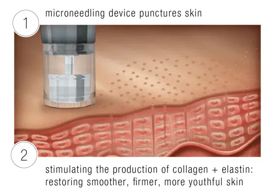 Skinney Medspa Treatments