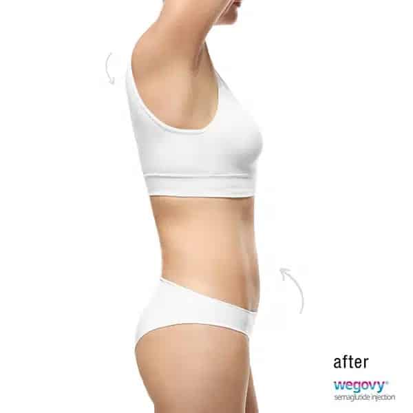 Skinney Medspa Semaglutide NYC Injection After Treatment Weight Loss