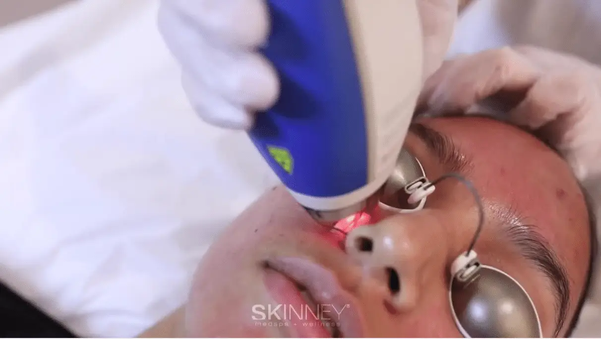 Skinney Medspa Treatments