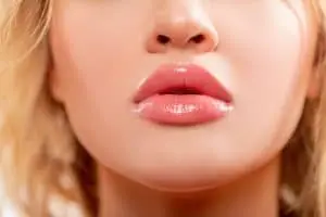A woman with perfect cherry lips is promoting the Juvéderm for Lips treatment at Skinney Medspa in New York City.