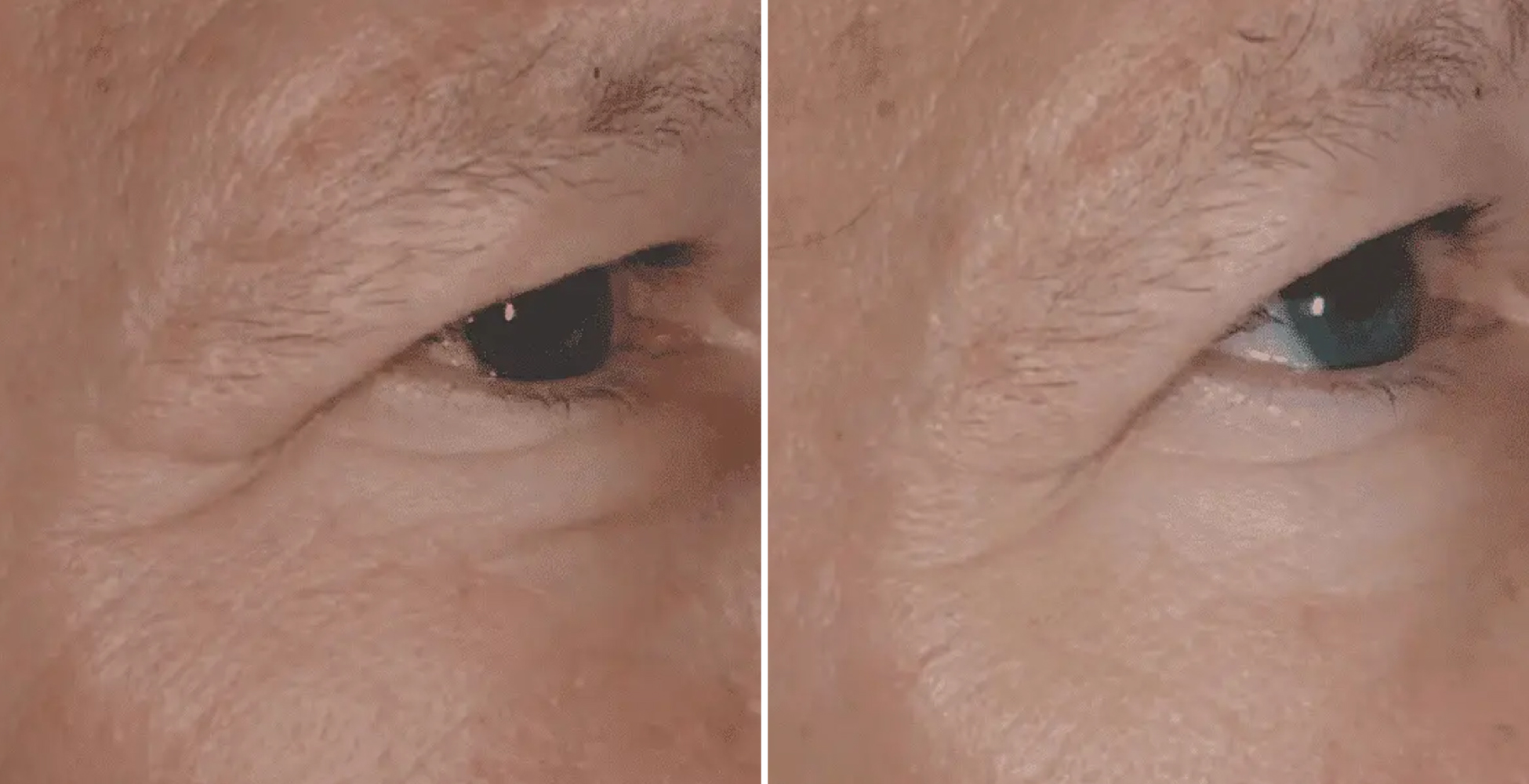 Aquagold Before & After