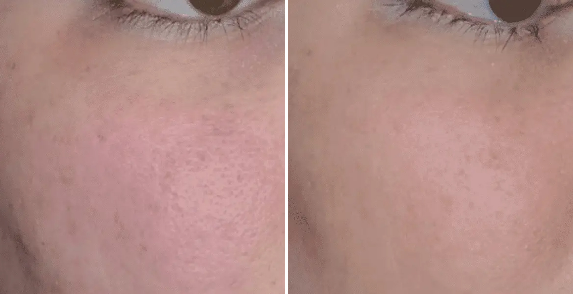 Aquagold Before & After