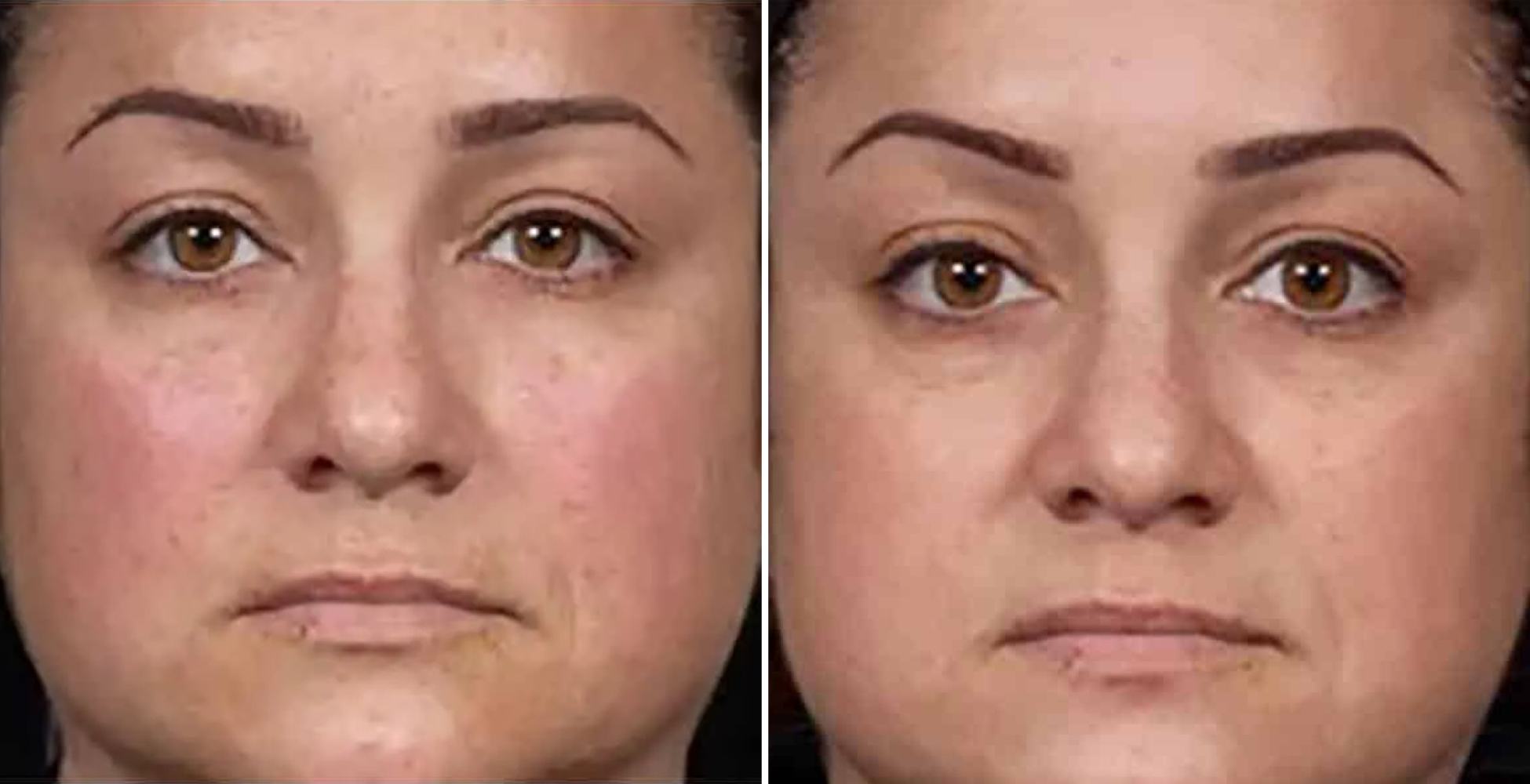 Clear + Brilliant After & Before