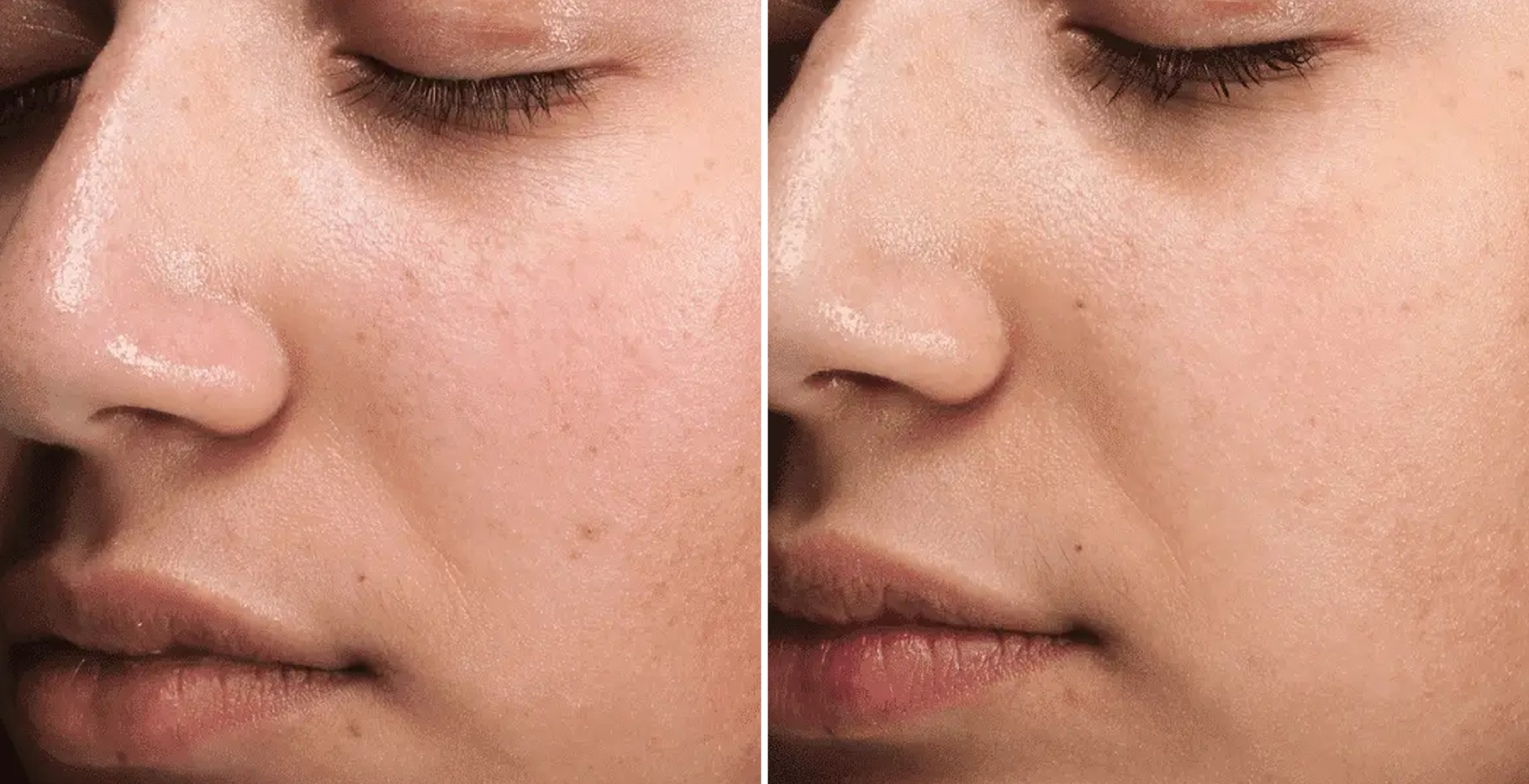 Clear + Brilliant After & Before