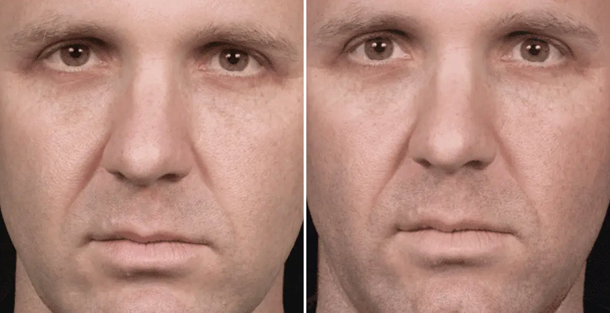 Clear + Brilliant After & Before