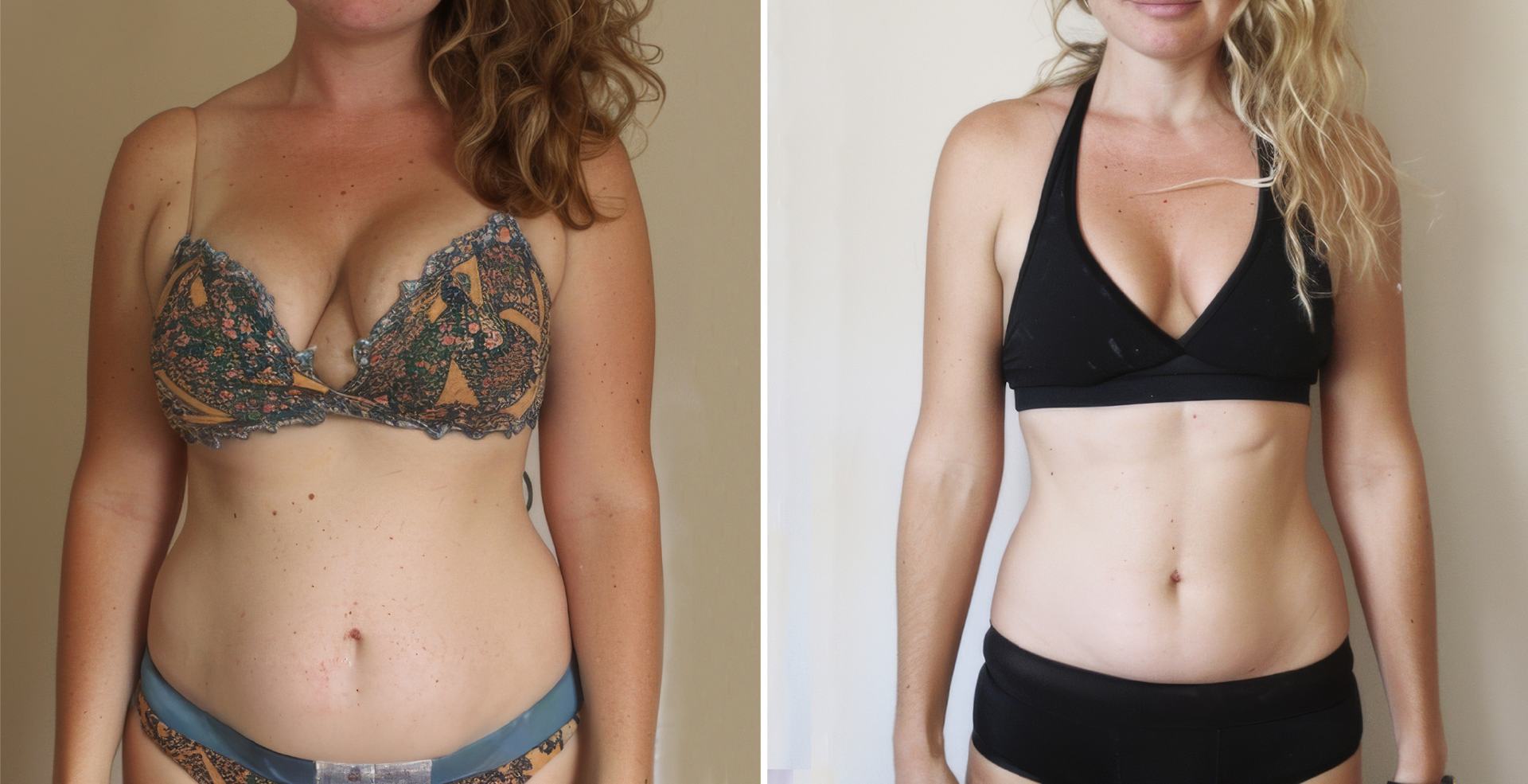 Semaglutide Before And After