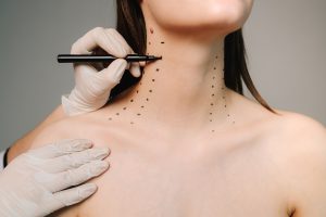 Nefertiti botox neck lift SKINNEY Medspa NYC Miami