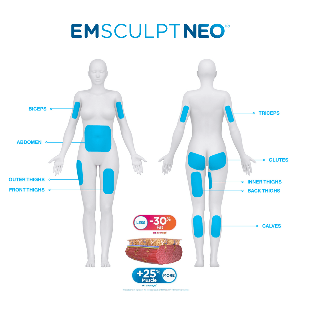 Emsculpt NEO